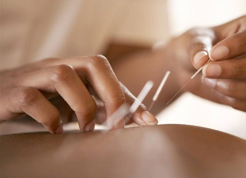 针灸