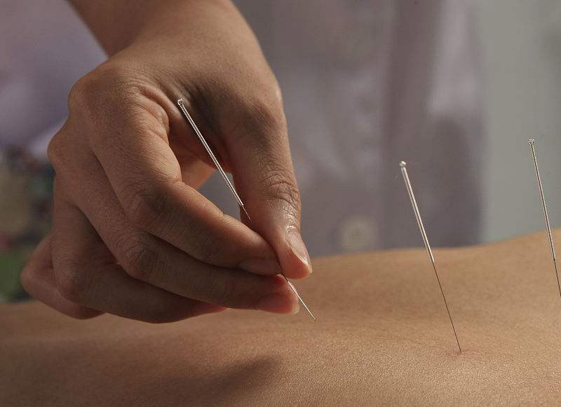 针灸