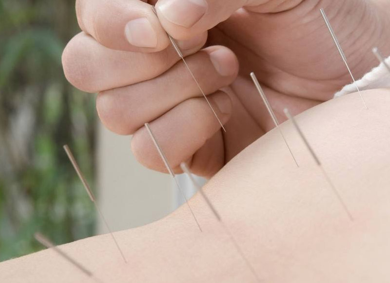 针灸