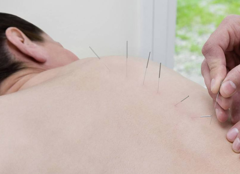 针灸