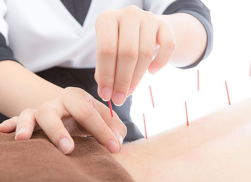 针灸